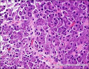 Image D: H&E stain, high magnification.