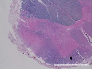 Image C: Spinal cord, LFB/H&E.