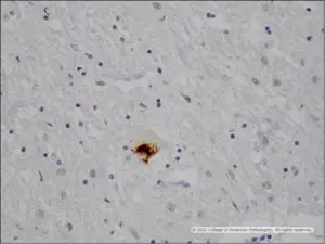 Image E: Brain, primary motor cortex, TDP-43.