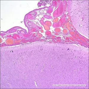 Image C: H&E.