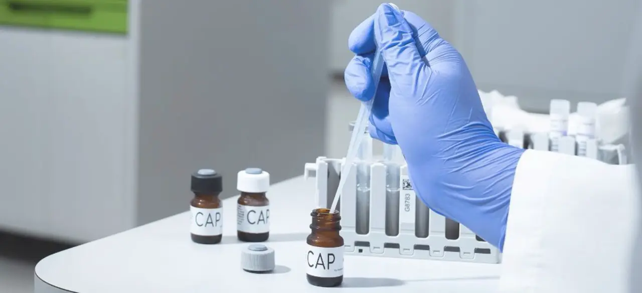 A gloved hand uses a dropper to add liquid to a small labeled vial ('CAP') beside a rack of test tubes in a laboratory setting.
