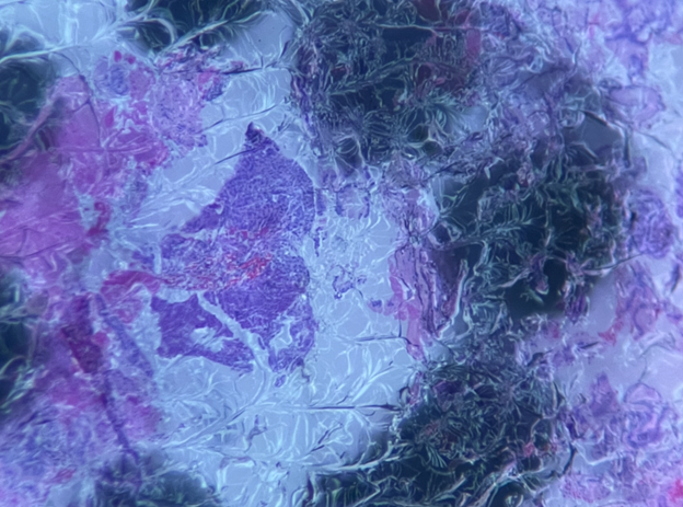 Example of tissue with coverslip removed.