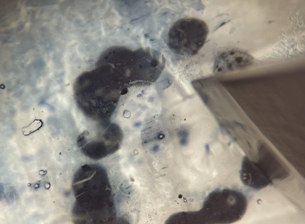 Tip of scalpel at site of tissue sampling.