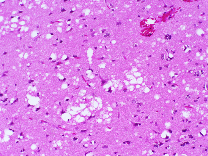 Image C