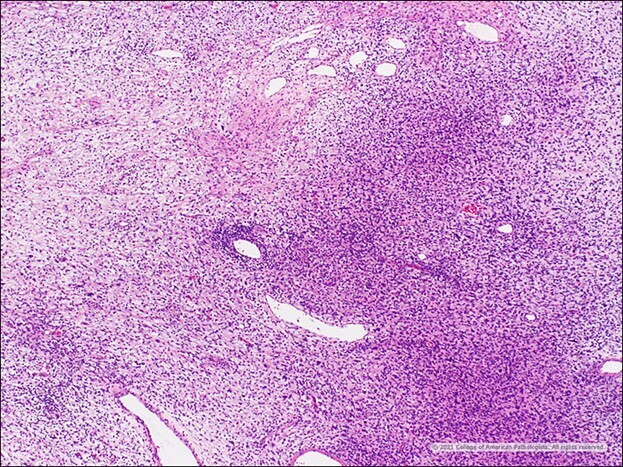 Image B: H&E.