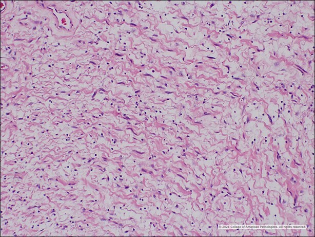 Image C: H&E.