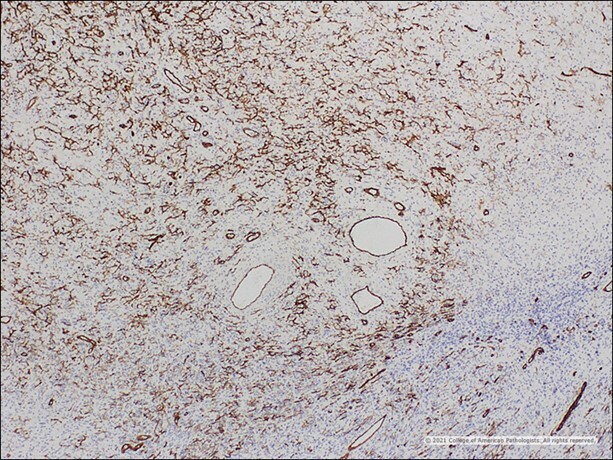 Image H: CD34.