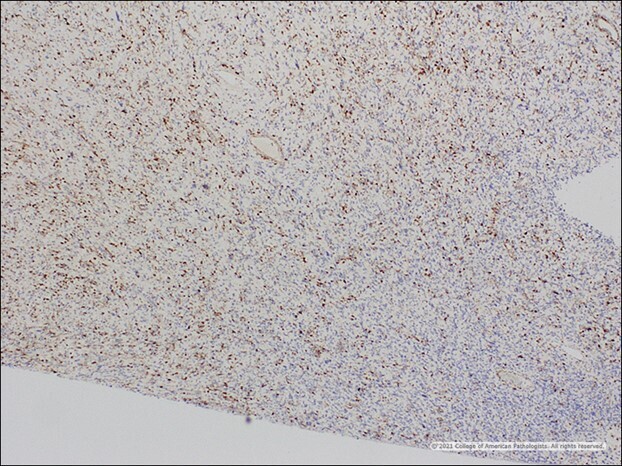 Image I: p16.