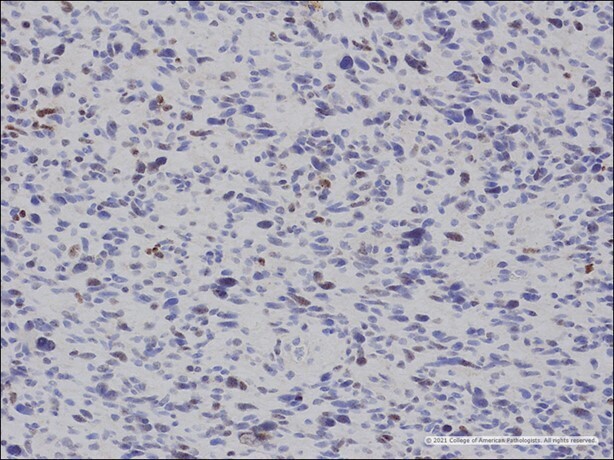 Image J: p53.